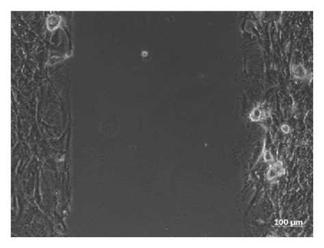 Images of cell migration. Images show the time course of the migration ...