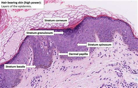 Skin – Normal Histology – NUS Pathweb :: NUS Pathweb