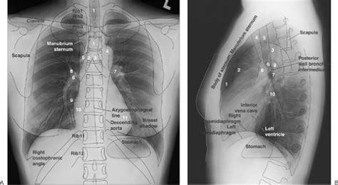 Ovid: Chest Radiology: The Essentials