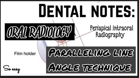 PARALLELING ANGLE TECHNIQUE II PERIAPICAL INTRAORAL RADIOGRAPHIC TECHNIQUE II ORAL RADIOLOGY ...