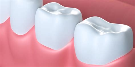 Soft Tissue Treatment | Melbourne, FL | Wickham Dental Care (& Implant ...