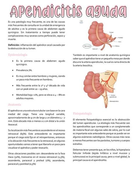 Apendicitis aguda | Polita.medicina | uDocz