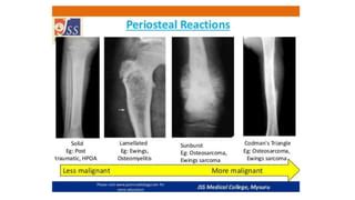 Periosteal Reaction Causes