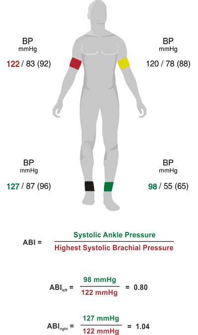 Ankle-Brachial-Index | medis. GmbH