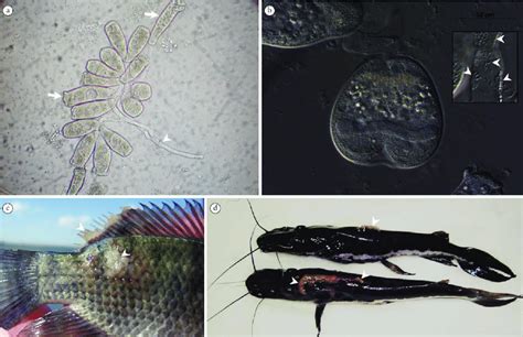 Epistylis sp. (a) in fresh-mounted slide under light microscope. Zooid ...