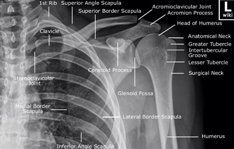 X-ray Vision - Shoulders and Elbows — Taming the SRU