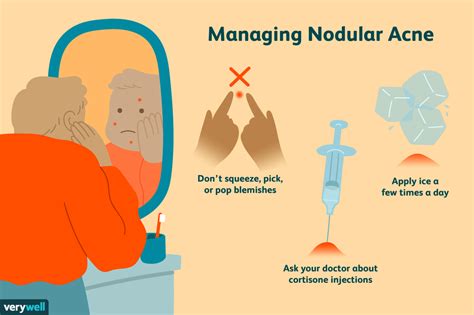 Causes of Nodular Acne and How to Treat It