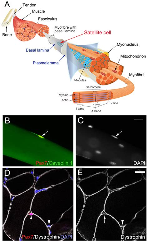 Figure 1 from Satellite cells are essential for skeletal muscle ...