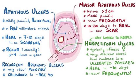 aphthous ulcer,what to do?