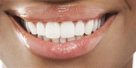 Astounding Smile Restoration With Cosmetic Dental Implants