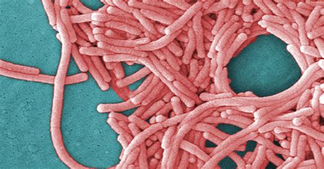 What is Legionnaires' disease?