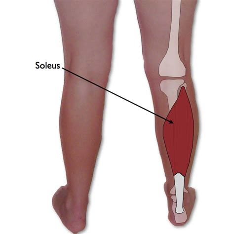 Soleus Trigger Points and Heel Pain | TriggerPointTherapist.com