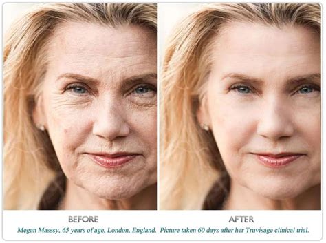 Anti Aging Facial Cream - ANTI-AGING FORMULAR : BETTER THAN BOTOX! | Anti Age Cream For Women