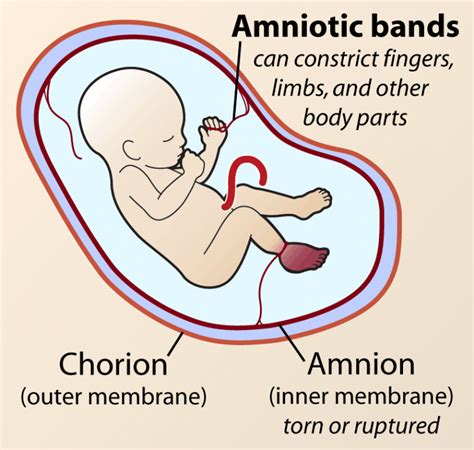 Fetal membrane layers, Chorion, Amnion, Yolk sac & umbilical cord | Science online