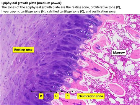 Bone – Normal Histology – NUS Pathweb :: NUS Pathweb