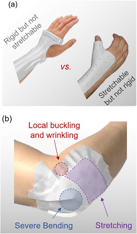 (a). Bandages that typically combine different types of large... | Download Scientific Diagram