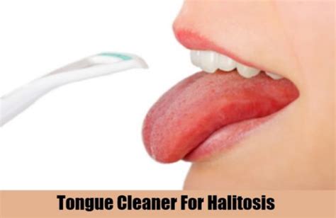 Top 5 Home Remedies For Halitosis - Natural Treatments And Cure For ...