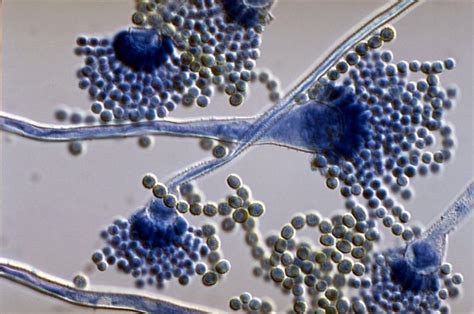 ¿Qué es el Aspergillus? | Radio Galicia | Cadena SER