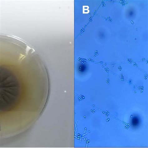 Mycological culture of sporotrichosis. (A) Colony morphology of ...