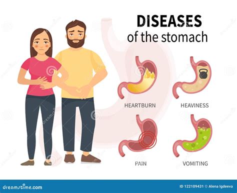 Diseases of the stomach stock vector. Illustration of doctor - 122109431