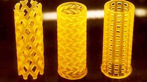 Researchers create a 3D-printed bioresorbable airway stent - Nerd News ...