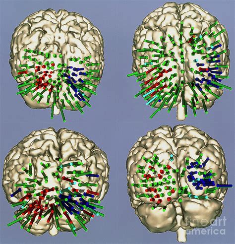 Functional Map Of The Brain's Visual Cortex Areas Photograph by Mit Ai ...