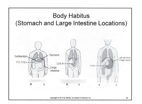 body habitus stomach/large intestine locations Diagram | Quizlet