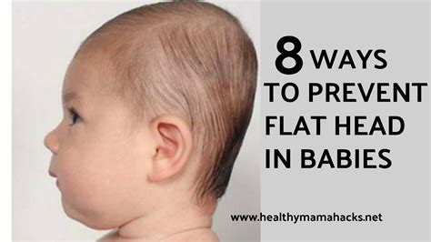 Plagiocephaly: How to Prevent Flat Head in Babies | Healthy Mama Hacks