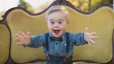 Toddler with Down Syndrome lands modeling gig - CNN Video