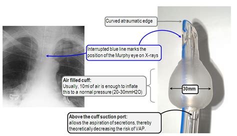 Endotracheal Tube Size Right