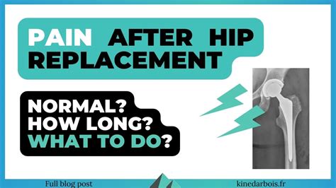 Thigh Pain after Hip Replacement - Treatment? Recovery Time?