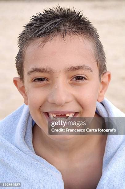 32 Kids Rotten Teeth Stock Photos, High-Res Pictures, and Images ...