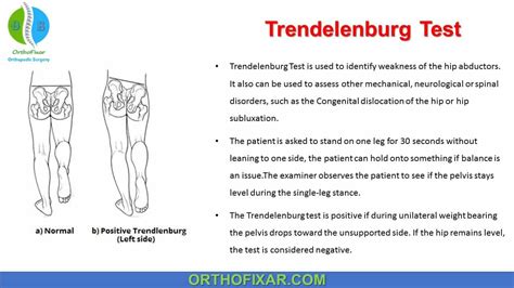 Trendelenburg Test Procedure - Easy Explained