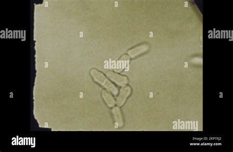 1970s: single cell fungus under microscope. Time lapse of bread rising ...