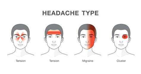 Learn These Important Headache Types Before They Get Dangerous…