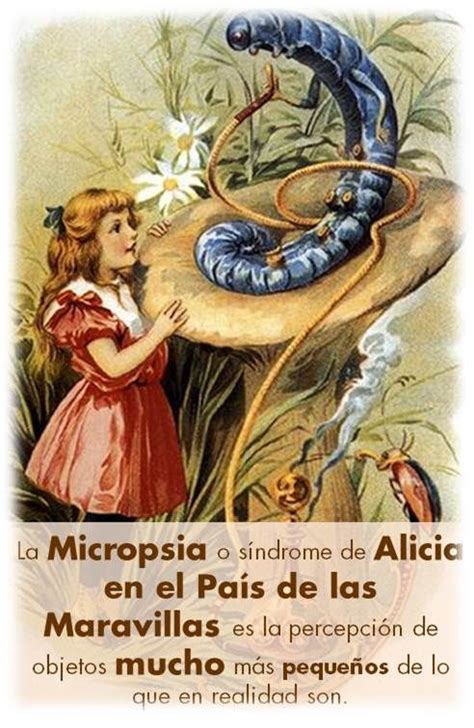 La Micropsia o síndrome de Alicia en el País de las Maravillas es la percepción de objetos mucho ...