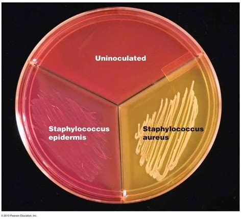 Mannitol Salt Agar: Principle, Uses, and Results • Microbe Online