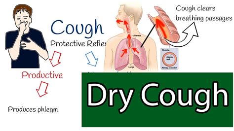 Dry cough, Chronic cough causes and treatment - YouTube