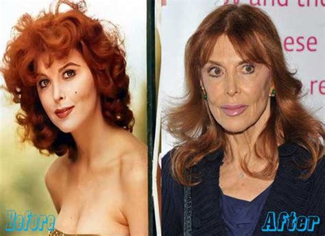 Tina Louise Plastic Surgery Before and After | | Plastic Surgery Magazine