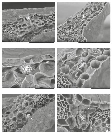 Calcium Oxalate Kidney Stones Microscope