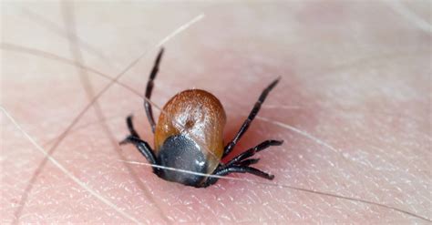 Which Ticks Carry Lyme Disease? – W3schools