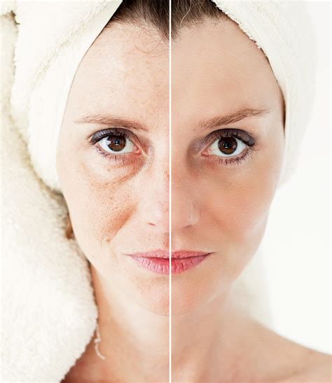 Younger Looking Skin | Short Hills Dermatology