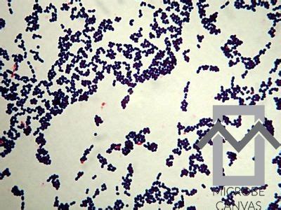 Enterococcus Gram Stain