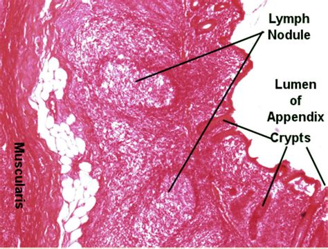 Appendix Histology Slides Labeled