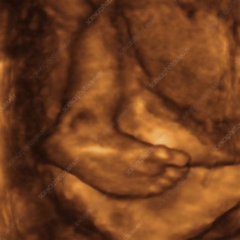 Foetus' foot, ultrasound scan - Stock Image - P680/0639 - Science Photo Library