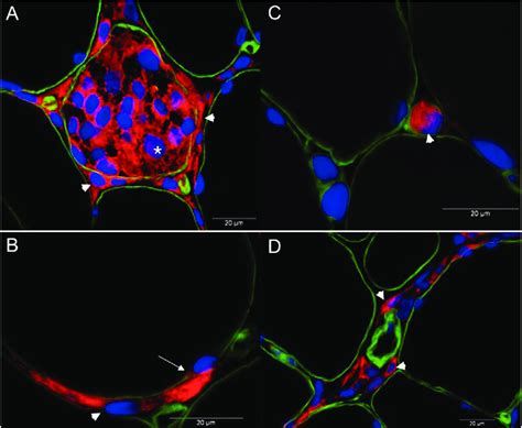 CD68 (red), laminin (basement membrane, green), and DAPI (nuclei, blue)... | Download Scientific ...