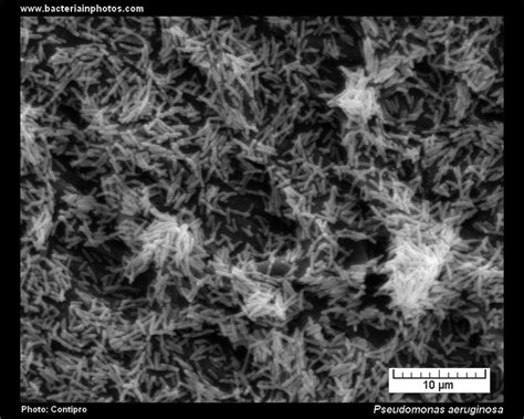 Pseudomonas aeruginosa biofilm. Formation of bacteria biofilm by P.aeruginosa