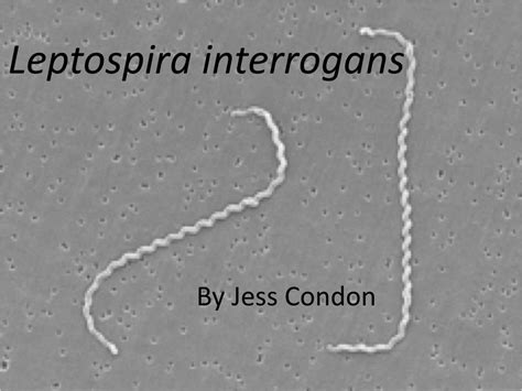 PPT - Leptospira interrogans PowerPoint Presentation, free download - ID:3725201