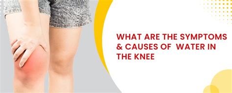 What Are The Symptoms & Causes Of Water In The Knee? | Germanten Hospital