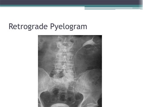 PPT - Urology PowerPoint Presentation, free download - ID:1649237